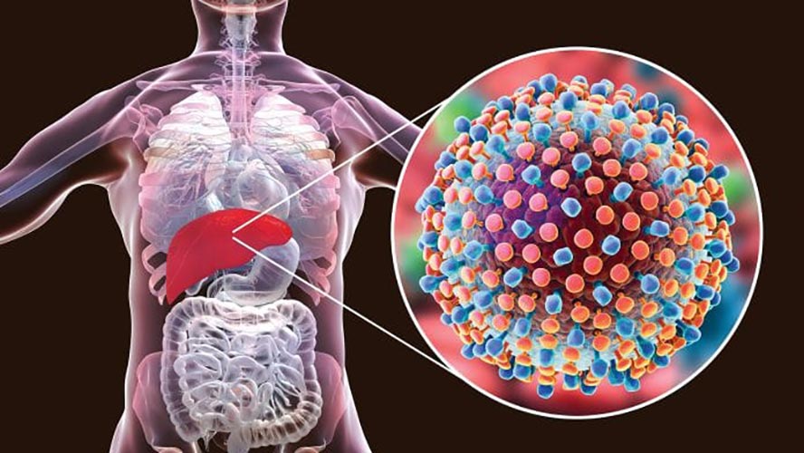 hepatitis-C-bela_omela
